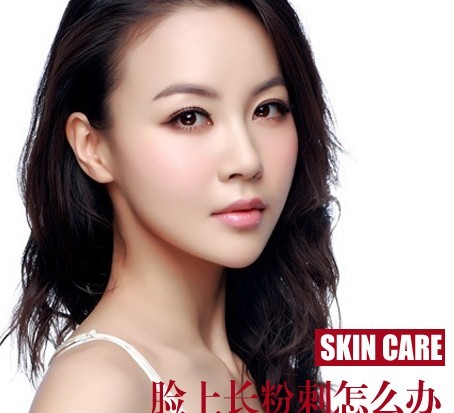 脸上长粉刺怎么办 走出七个误区告别粉刺