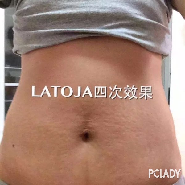 瘦腿专业减肥产品LATOJA减肥真的好用?最快见效怎样减肥图片