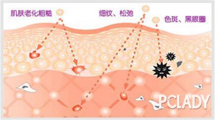 全面书写光子嫩肤好不好，光子嫩肤能维持多久，光子嫩肤多少钱一次!