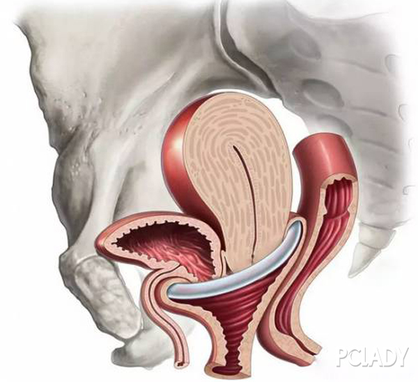 剖腹产坐月子怎么样才能让子宫脱垂恢复的快?
